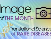 Translational science of rare diseases - image of the month
